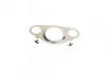 Комплект прокладок BMW 1/2/3/4/5/X1/X3 N47 03- (без прокладки ГБЦ/верхній)) ELRING 537540 (фото 9)