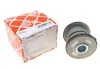 К-т втулок рессоры FEBI BILSTEIN 101363 (фото 1)